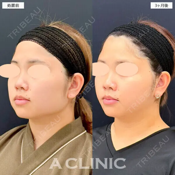 A CLINIC（エークリニック） 横浜院 柴田 貴志医師の症例