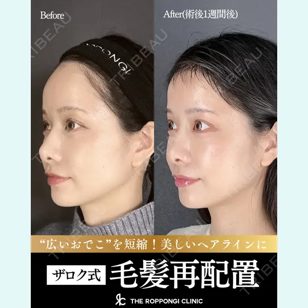 THE ROPPONGI CLINIC（ザ 六本木クリニック） 石黒 昂医師の症例