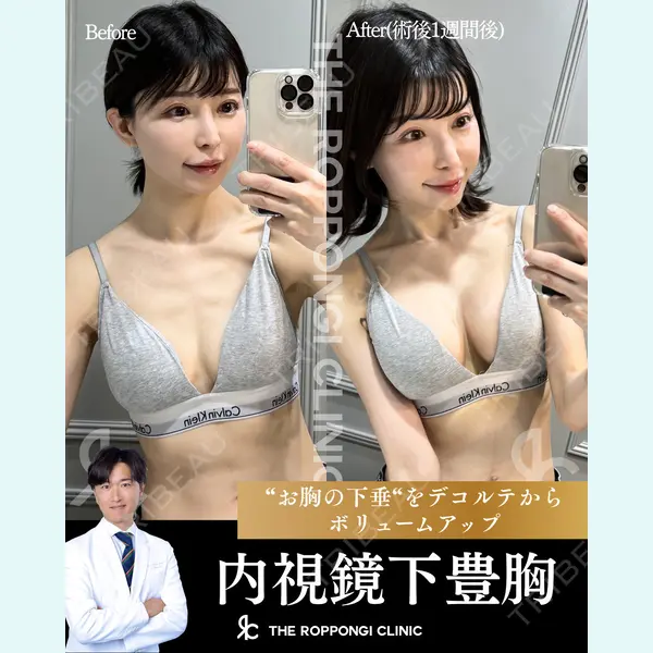 THE ROPPONGI CLINIC（ザ 六本木クリニック） 石黒 昂医師の症例