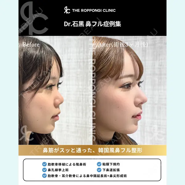 THE ROPPONGI CLINIC（ザ 六本木クリニック） 石黒 昂医師の症例