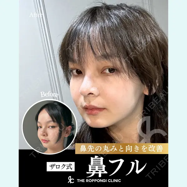 THE ROPPONGI CLINIC（ザ 六本木クリニック） 石黒 昂医師の症例