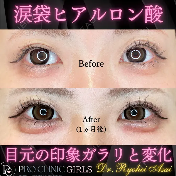 PRO CLINIC プロクリニック 銀座院 浅井 亮平医師の症例