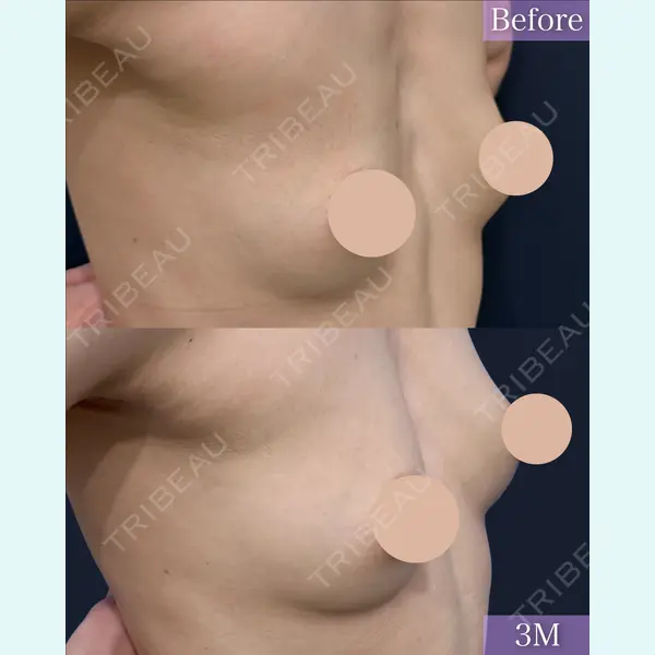 湘南美容クリニック 神戸三宮院 河上 帆乃佳医師の症例