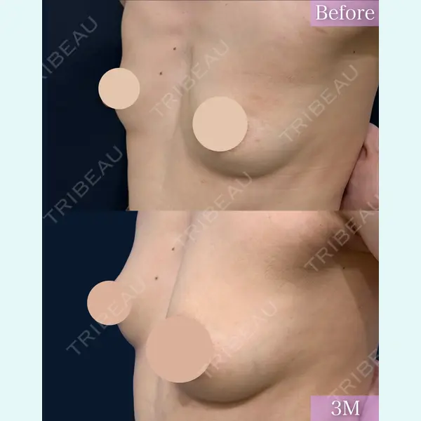 湘南美容クリニック 神戸三宮院 河上 帆乃佳医師の症例