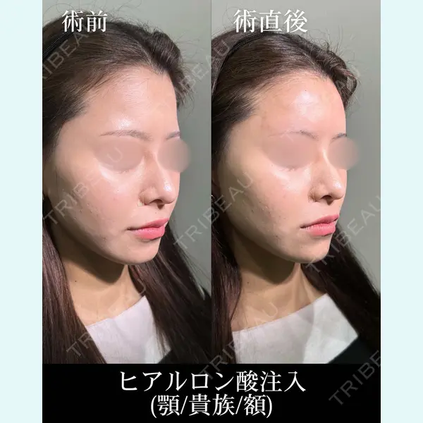 HAAB×DREAM BEAUTY CLINIC 大阪梅田院 錦 実奈医師の症例