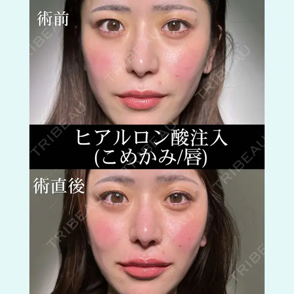 HAAB×DREAM BEAUTY CLINIC 大阪梅田院 錦 実奈医師の症例