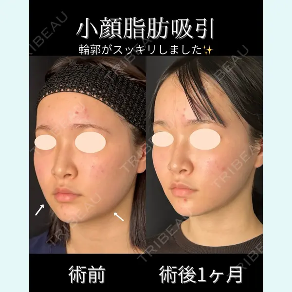 ルラ美容クリニック 仙台院 / ルラスキンクリニック 仙台院 橋本 英樹医師の症例