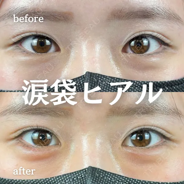 ルラ美容クリニック 新宿院 陶 美梨医師の症例