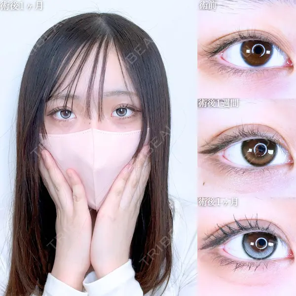 アリエル美容クリニック 郡山院 安齋 誠基医師の症例