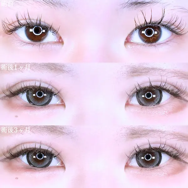 アリエル美容クリニック 郡山院 安齋 誠基医師の症例