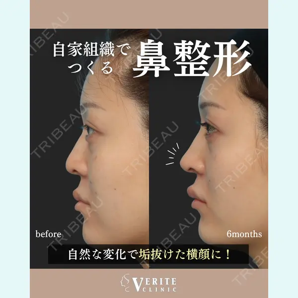 ヴェリテクリニック 名古屋院 仲宗根 美佳医師の症例