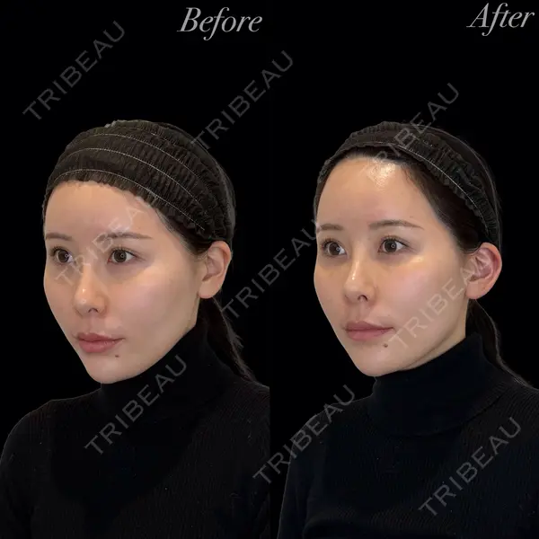 R Beauty CLINIC 銀座院 岩本　昌樹医師の症例