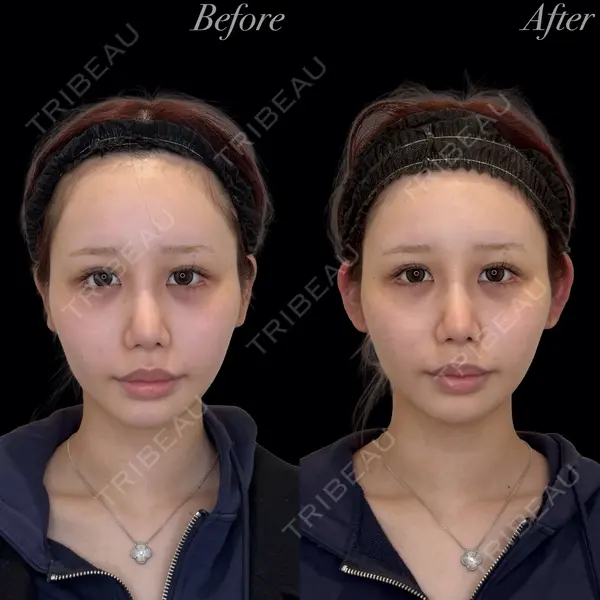 R Beauty CLINIC 銀座院 岩本　昌樹医師の症例