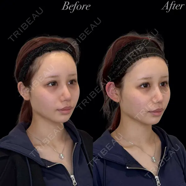 R Beauty CLINIC 銀座院 岩本　昌樹医師の症例