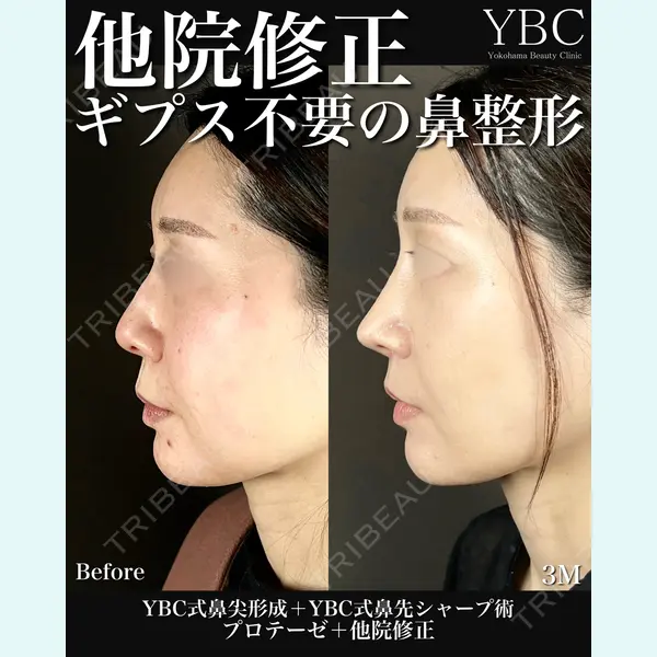 YBC横浜美容外科 池袋院 磯村 亮輔医師の症例