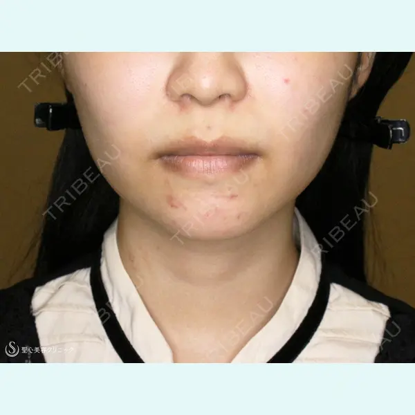 聖心美容クリニック 札幌院 前多 一彦医師の症例