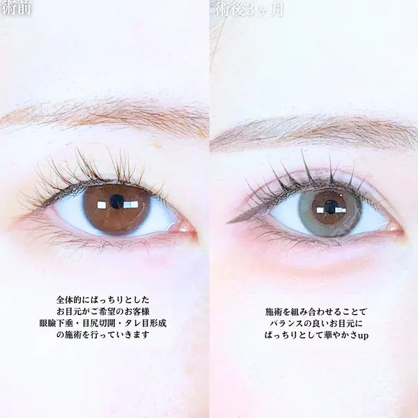 アリエル美容クリニック 大宮院 江郷隼一郎医師の症例