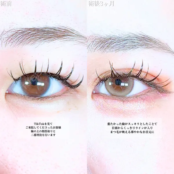 アリエル美容クリニック 大宮院 鈴木　桂介医師の症例