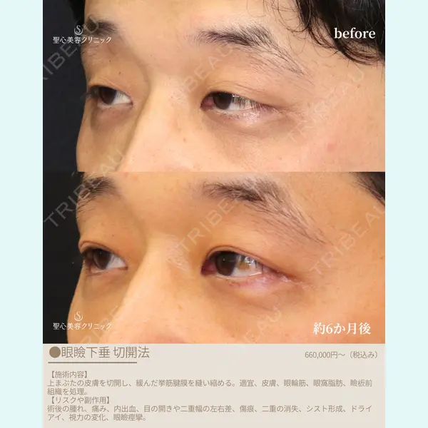 聖心美容クリニック 福岡院 權藤 理絵医師の症例