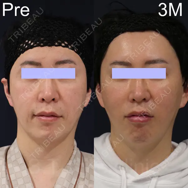 S.T styleクリニック 徳田 真紀子医師の症例