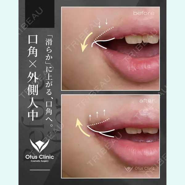 Otus Clinic 【オータスクリニック】 中 徳太郎医師の症例