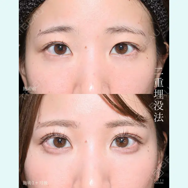 藤・ナチュレ美容クリニック 銀座院 小川 杏平医師の症例