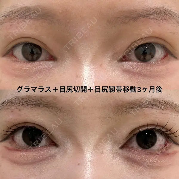 エターナル美容クリニック 久門田 詳医師の症例