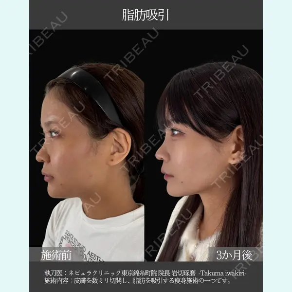 ネビュラクリニック 東京錦糸町院 岩切 琢磨医師の症例