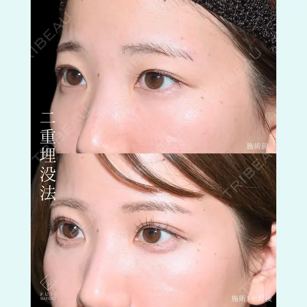 藤・ナチュレ美容クリニック 銀座院 小川 杏平医師の症例