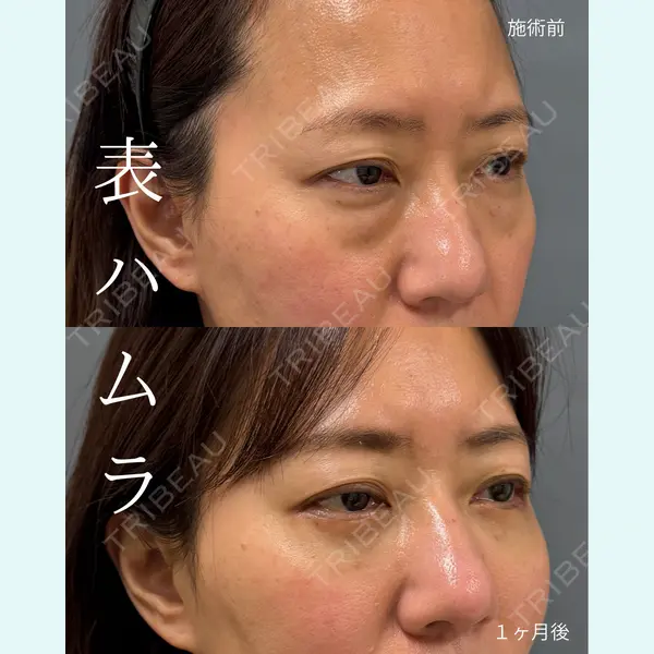 春山記念病院 山田 浩之医師の症例