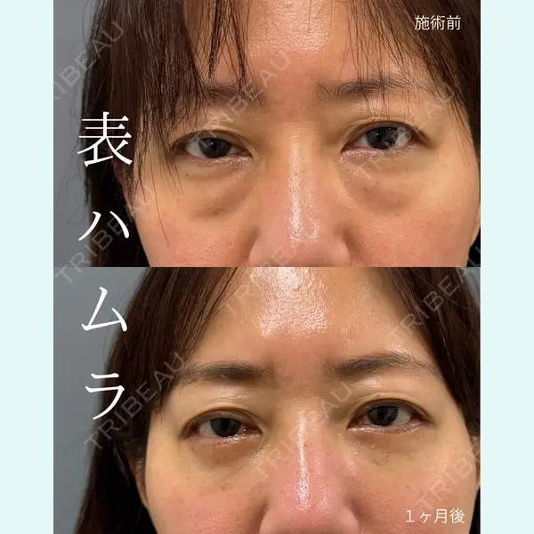 春山記念病院 山田 浩之医師の症例