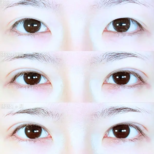 アリエル美容クリニック 大宮院 江郷隼一郎医師の症例