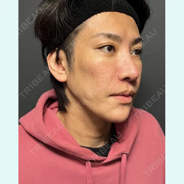 表参道ウィズ・クリニック 太田 恵介医師の症例