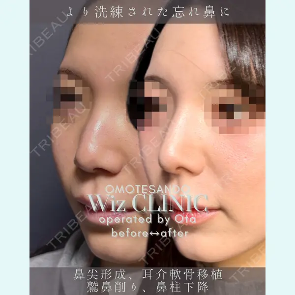 表参道ウィズ・クリニック 太田 恵介医師の症例