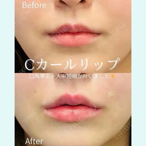 ルラ美容クリニック 仙台院 / ルラスキンクリニック 仙台院 橋本 英樹医師の症例