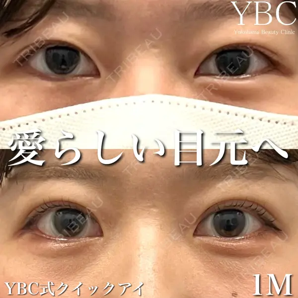 YBC横浜美容外科 大宮院 磯村 亮輔医師の症例