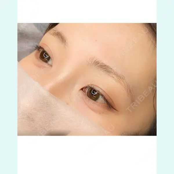 さっぽろ美容クリニック 小春かずみ医師の症例