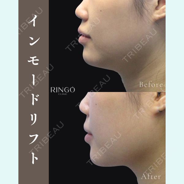 RINGO CLINIC 西田 有加莉医師の症例
