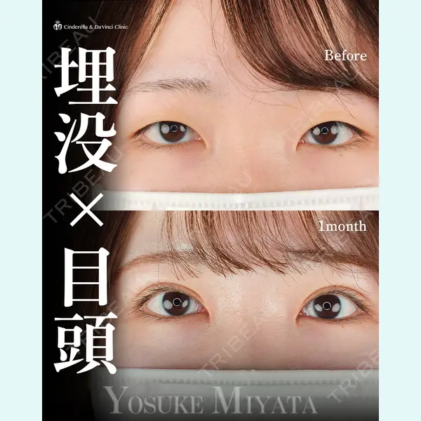 シンデレラ＆ダヴィンチクリニック 宮田 洋佑医師の症例