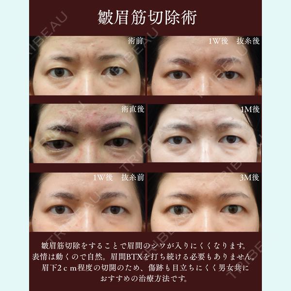 芦屋美容クリニック 銀座院 小西　和人医師の症例