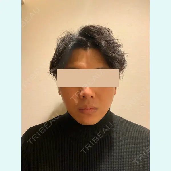 Rinato Beauty Clinicの症例