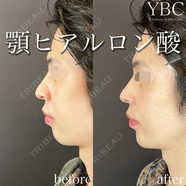 YBC横浜美容外科 池袋院 磯村 亮輔医師の症例