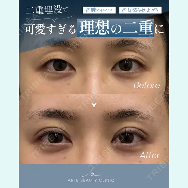 ARTE BEAUTY CLINICの症例