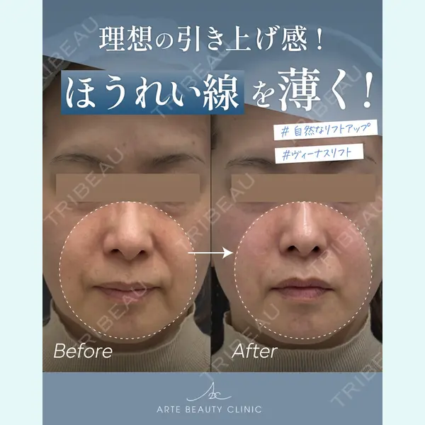 ARTE BEAUTY CLINICの症例