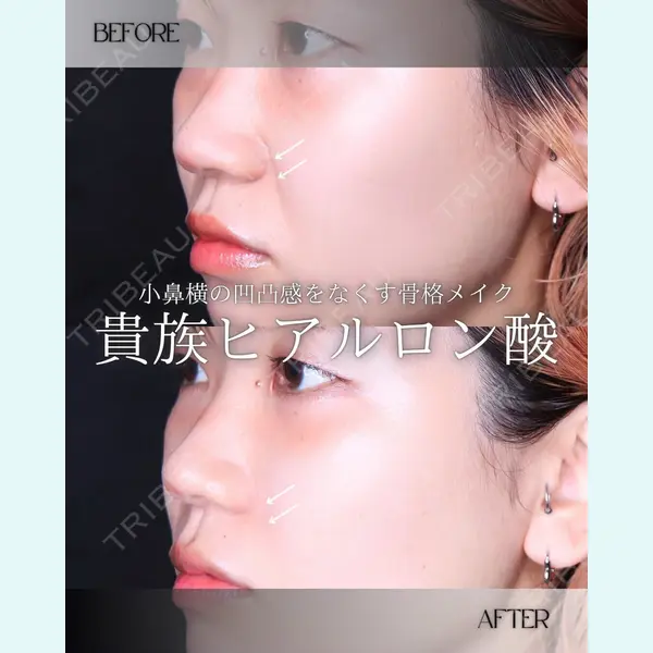 博多美容外科/美容皮膚科 ビラビューティークリニック 大村 亞蘭医師の症例