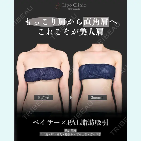 Lipo Clinic omotesando 福田 越医師の症例
