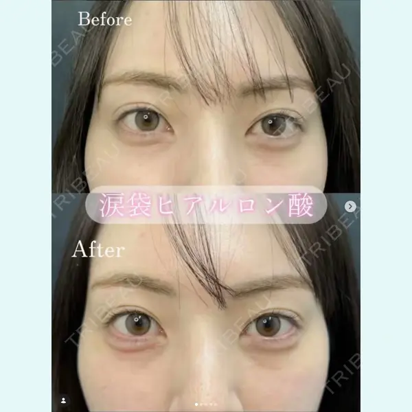 ルラ美容クリニック 沖縄院 上地 聖矢医師の症例