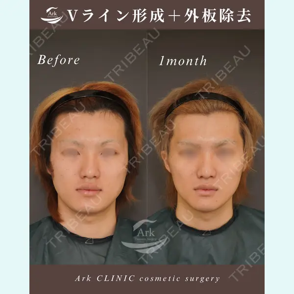 アーククリニック 加藤 雄大医師の症例