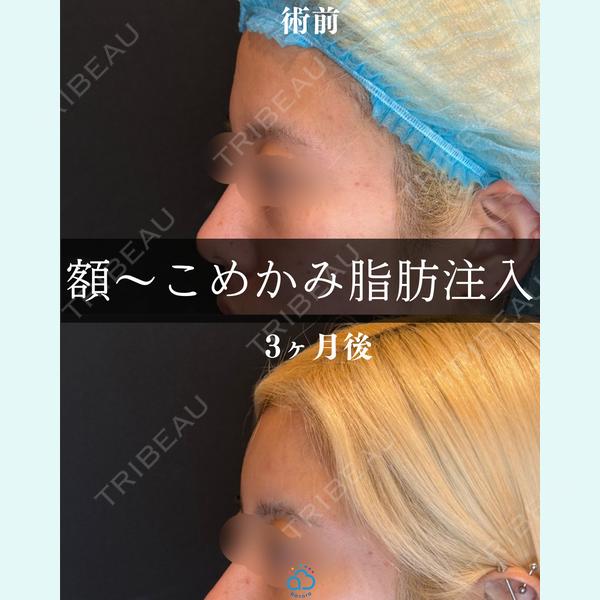 渋谷あおぞらクリニック美容外科・美容皮膚科 鶴田 優希医師の症例