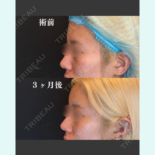 渋谷あおぞらクリニック美容外科・美容皮膚科 鶴田 優希医師の症例